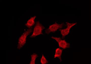 Polyclonal Rabbit anti-Human CDH3 / P-Cadherin Antibody (IHC, IF, WB)