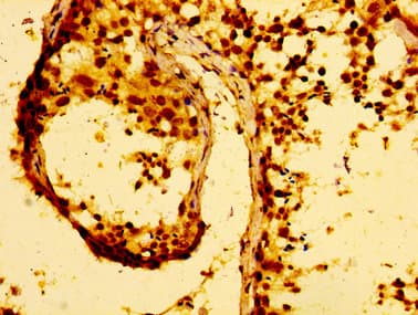Polyclonal Rabbit anti-Human MMP28 Antibody (IHC, IF, WB)