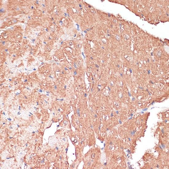 Polyclonal Rabbit anti-Human FRMD6 Antibody (IHC, IF)
