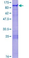 Human ZNF7 Protein (Recombinant GST)