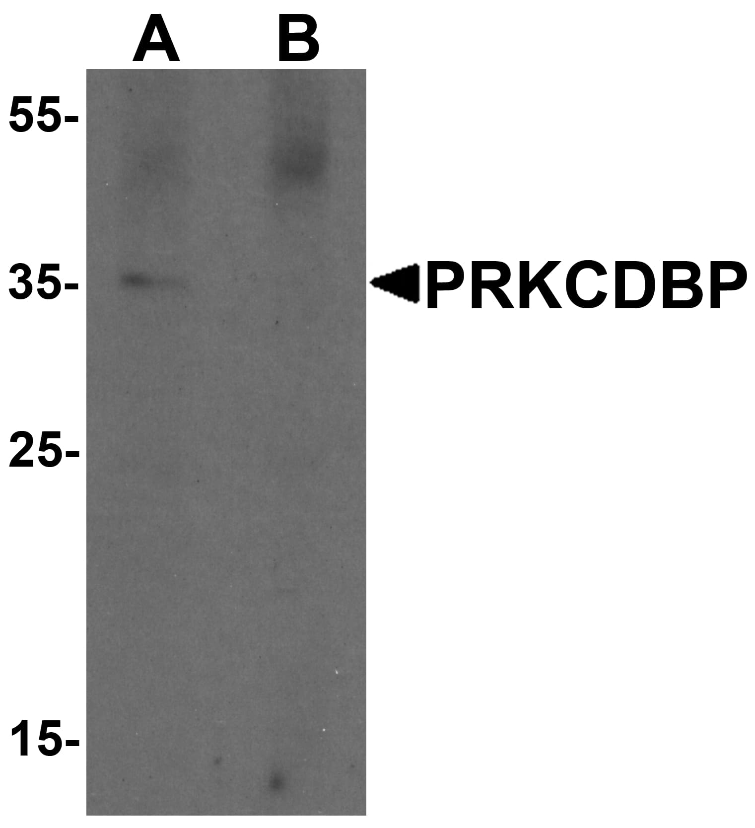 IHC-plus™ PRKCDBP / CAVIN3 Antibody