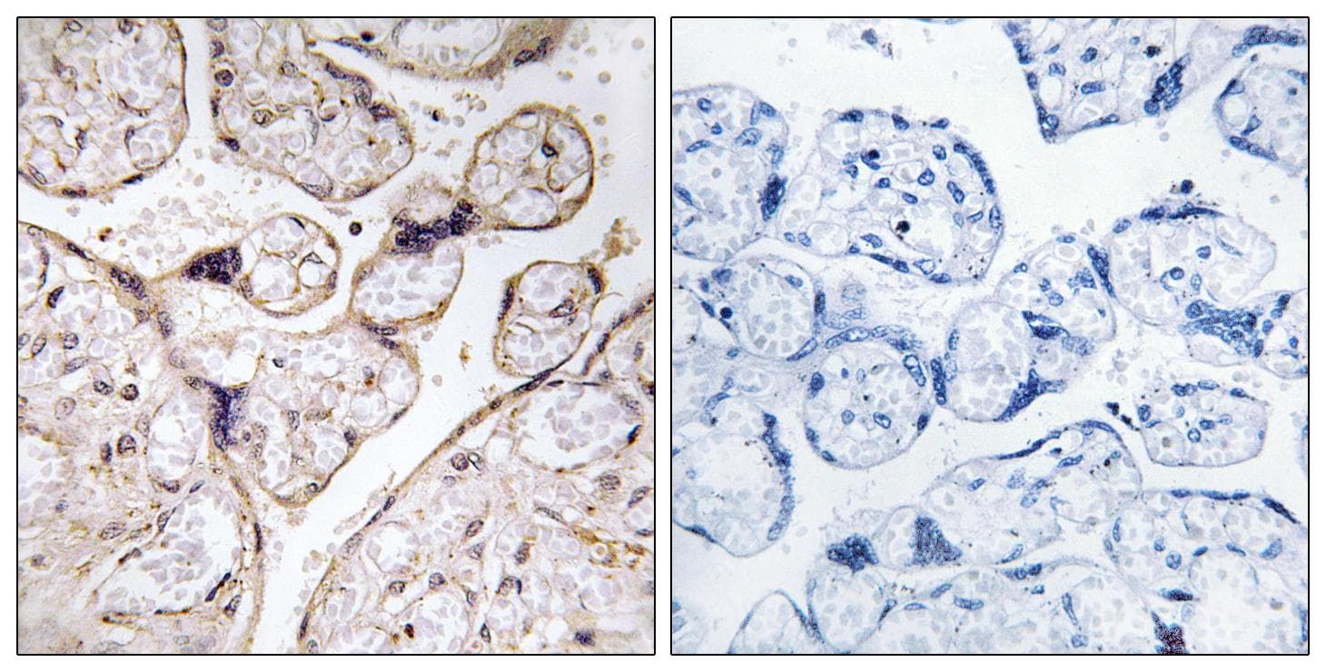 ACER3 Antibody