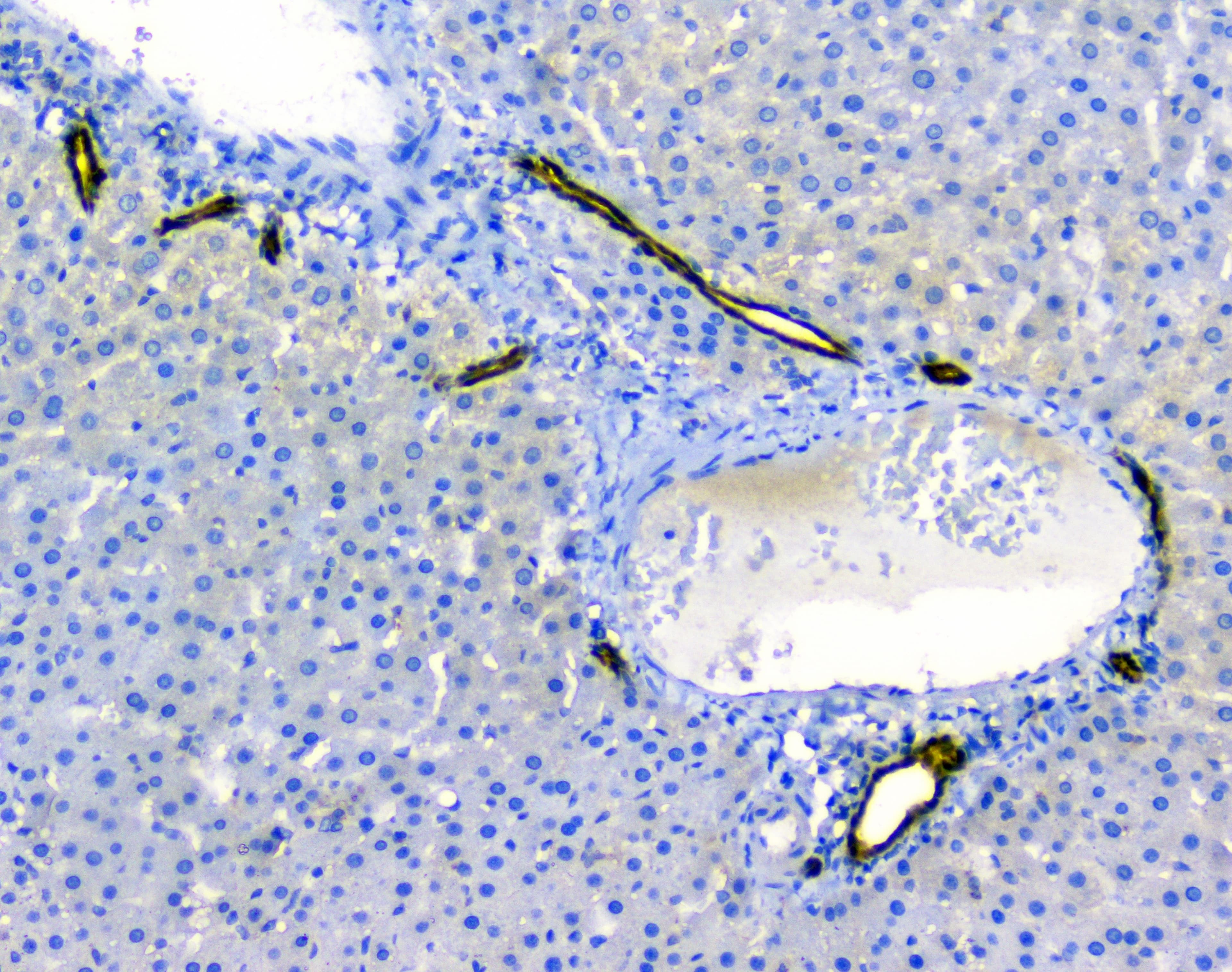 LGALS3 / Galectin 3 Antibody (aa139-250)