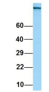 ITGAV/Integrin Alpha V/CD51 Antibody (C-Terminus)