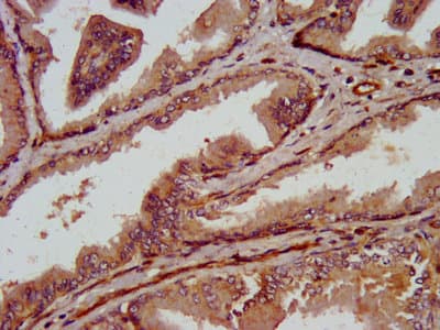 VRL1 / TRPV2 Antibody