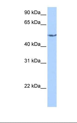 CRAT Antibody (aa22-71)