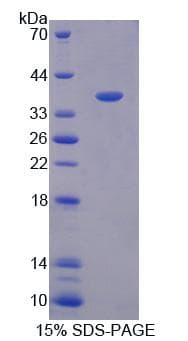 Human OSGIN1 Protein (Recombinant His-T7)