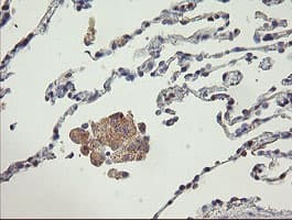 NNA1 / AGTPBP1 Antibody (clone OTI9A3)
