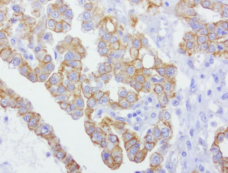 CDH2 / N Cadherin Antibody (clone UMAB23, Carrier-free)