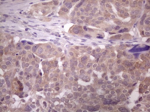 DMRT1 Antibody (aa1-210, clone 2H1, Carrier-free)