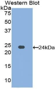 AFM / Afamin Antibody (aa211-403, PE)