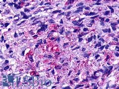 PathPlus™ GPR19 Antibody (Cytoplasmic Domain)