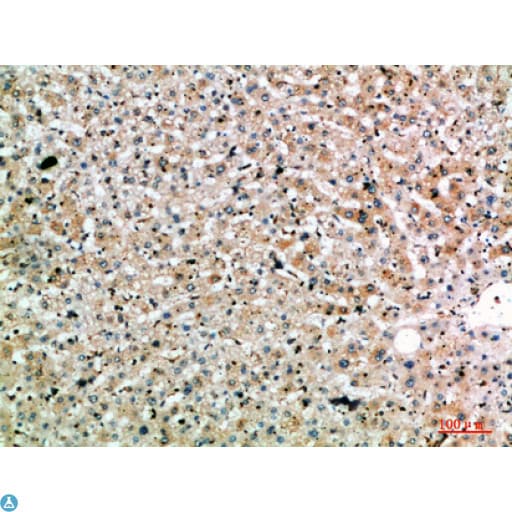 Polyclonal Rabbit anti-Human SPOP Antibody (WB)