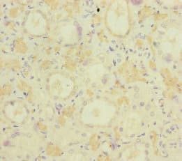 Polyclonal Rabbit anti-Human MOCS2 Antibody (IHC, IF, WB)