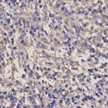 Polyclonal Rabbit anti-Human PRF1 / Perforin Antibody (IHC, IF, WB)