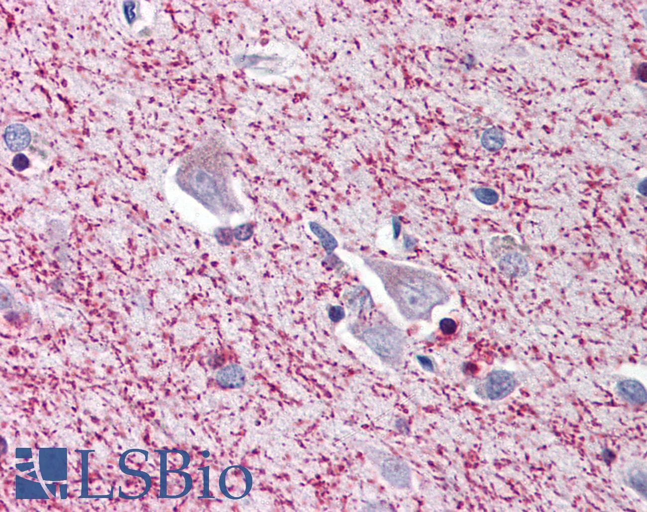 IHC-plus™ Polyclonal Rabbit anti-Human TRIM5 Antibody (IHC, IF, WB)