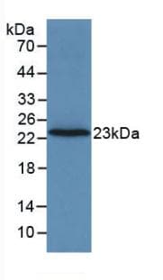 F2 / Prothrombin / Thrombin Antibody (aa44-200)
