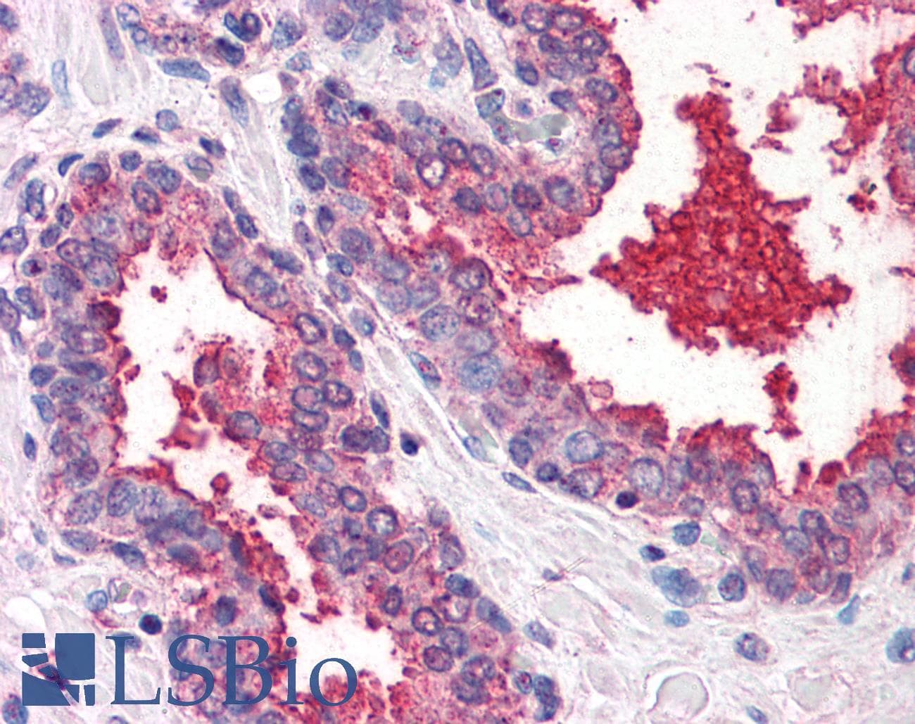 IHC-plus™ DPP4 / CD26 Antibody (Internal)
