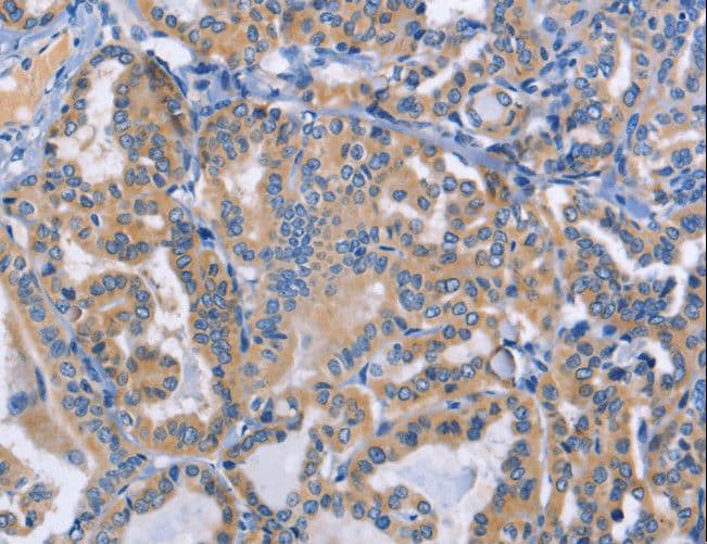 DOK4 Antibody