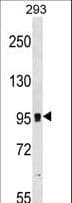 GRM7 / MGLUR7 Antibody (aa240-269)