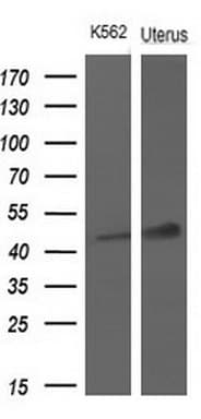 TNFRSF10A / DR4 Antibody (aa263-468, clone OTI8A12, Carrier-free)