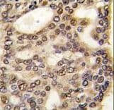 HDGF Antibody (aa171-197)