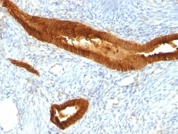EPCAM Antibody (clone MOC-31)