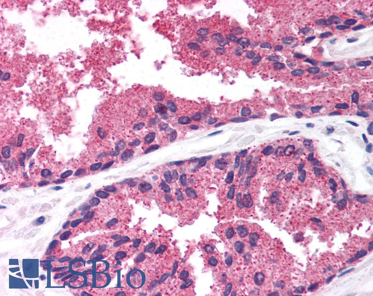LDB1 / CLIM2 Antibody (aa303-352)