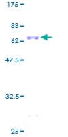 Human ECI2 / PECI Protein (Recombinant GST)