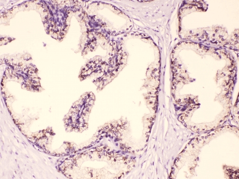 GAA / Alpha-Glucosidase, Acid Antibody