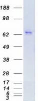 Human PRKCE / PKC-Epsilon Protein (Recombinant Myc-DDK (Flag))