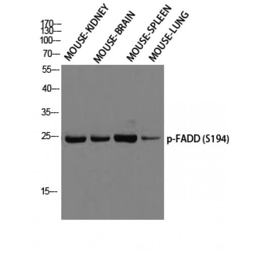 Polyclonal Rabbit anti-Human FADD Antibody (phospho-Ser194, IHC, WB)