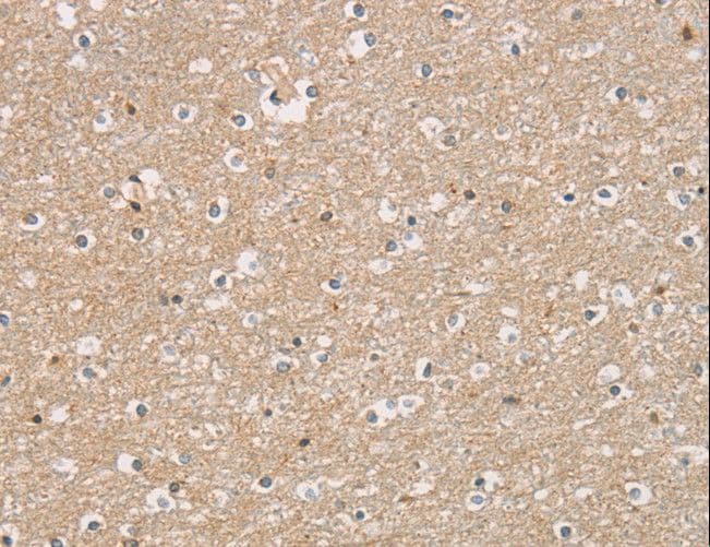 Polyclonal Rabbit anti-Human DMRTA3 / DMRT3 Antibody (IHC, WB)
