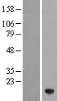 ZNRD1 Protein (Over-Expression Lysate Myc-DDK (Flag))