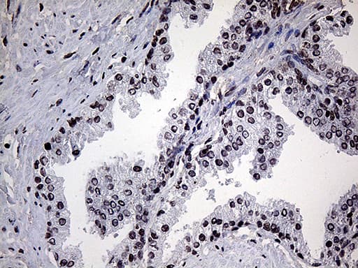 POLR3H Antibody (clone OTI4D8)
