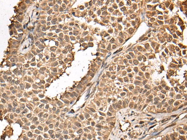 BUD31 Antibody