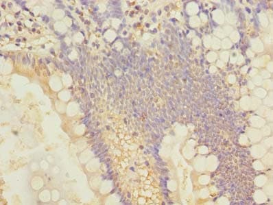 SLC25A4 / ANT Antibody