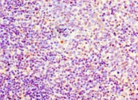 FLT3LG / Flt3 Ligand Antibody (aa27-184, Biotin)