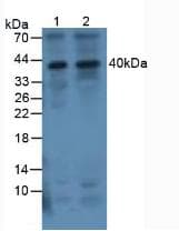 IL-1B / IL-1 Beta Antibody (aa117-268)