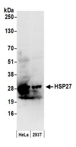 Polyclonal Rabbit anti-Human HSPB1 / HSP27 Antibody (aa155-205, IHC, WB)