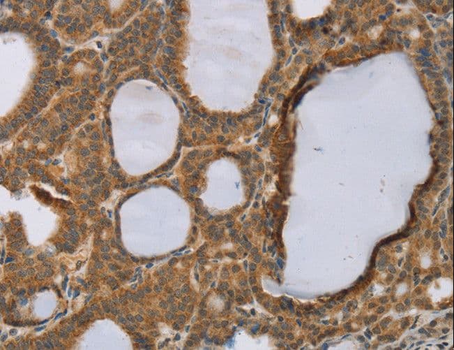 Polyclonal Rabbit anti-Human RMA1 / RNF5 Antibody (IHC, WB)