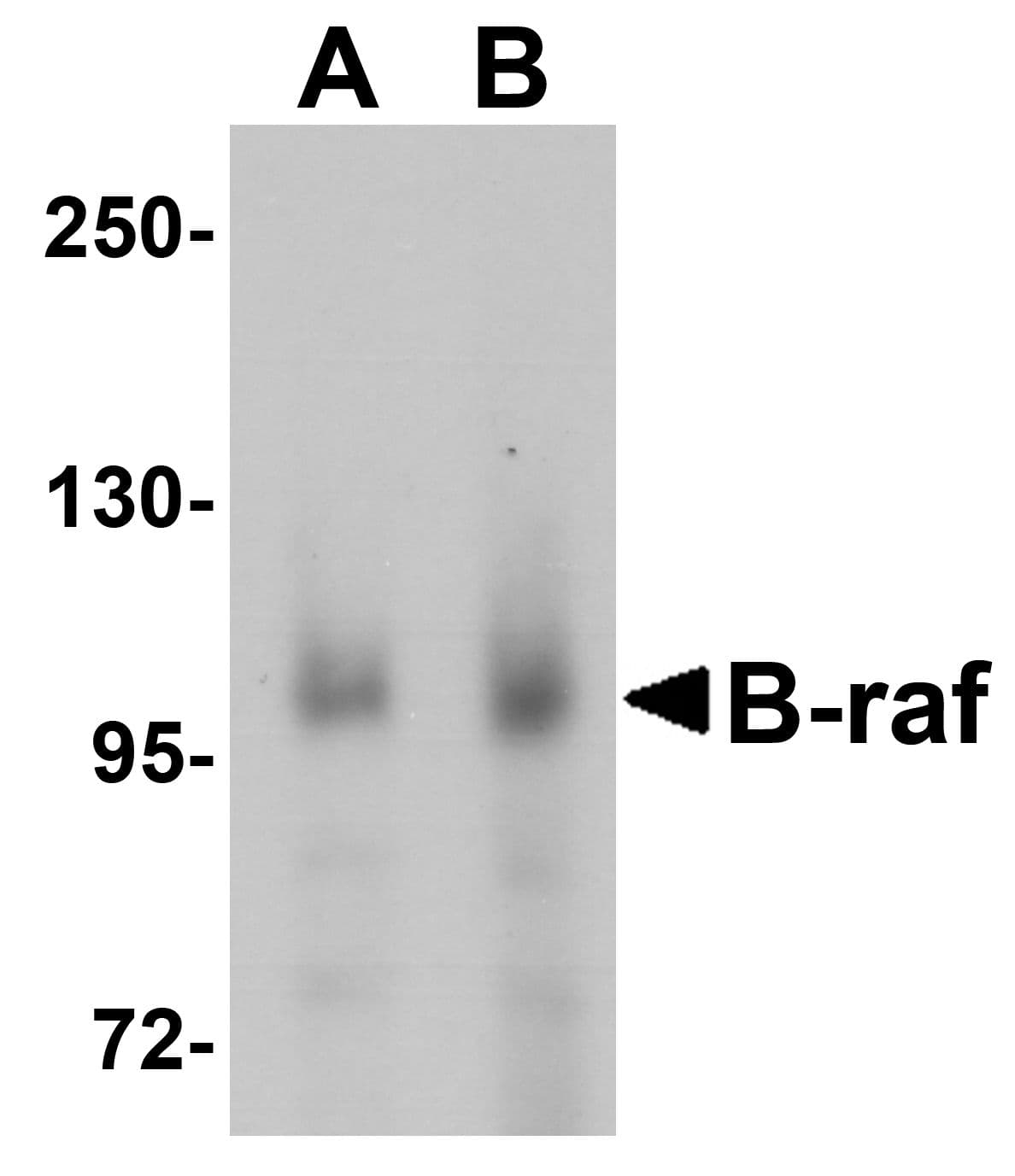 BRAF / B-Raf Antibody
