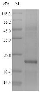 Human ZNF160 Protein (Recombinant 10His, N-terminus + Myc, C-terminus)