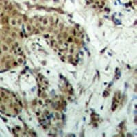 MECOM / EVI1 Antibody