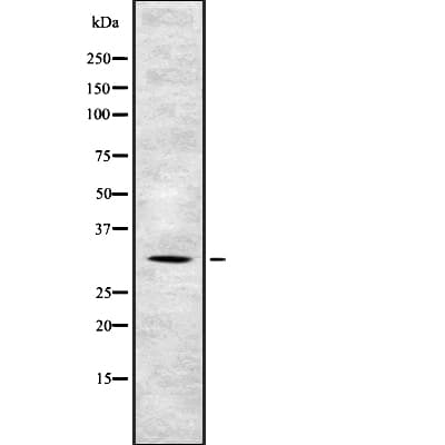 TSSC4 Antibody