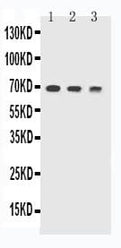 TREM1 Antibody (aa74-90)
