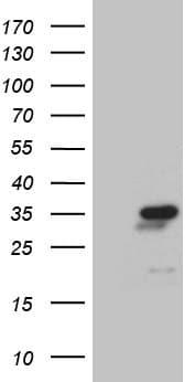 NABP1 / OBFC2A Antibody (clone OTI4D9)