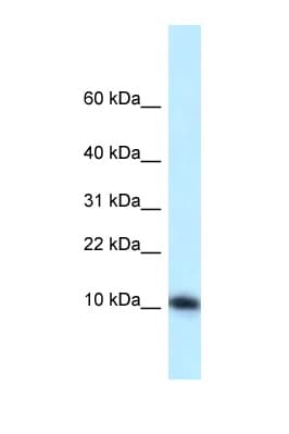 Polyclonal Rabbit anti-Mouse MED21 Antibody (aa19-68, WB)