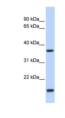 ZIC4 Antibody (N-Terminus)