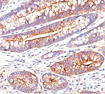 CEA / Carcinoembryonic Antigen Antibody (clone C66/261, Azide-free, BSA-free)